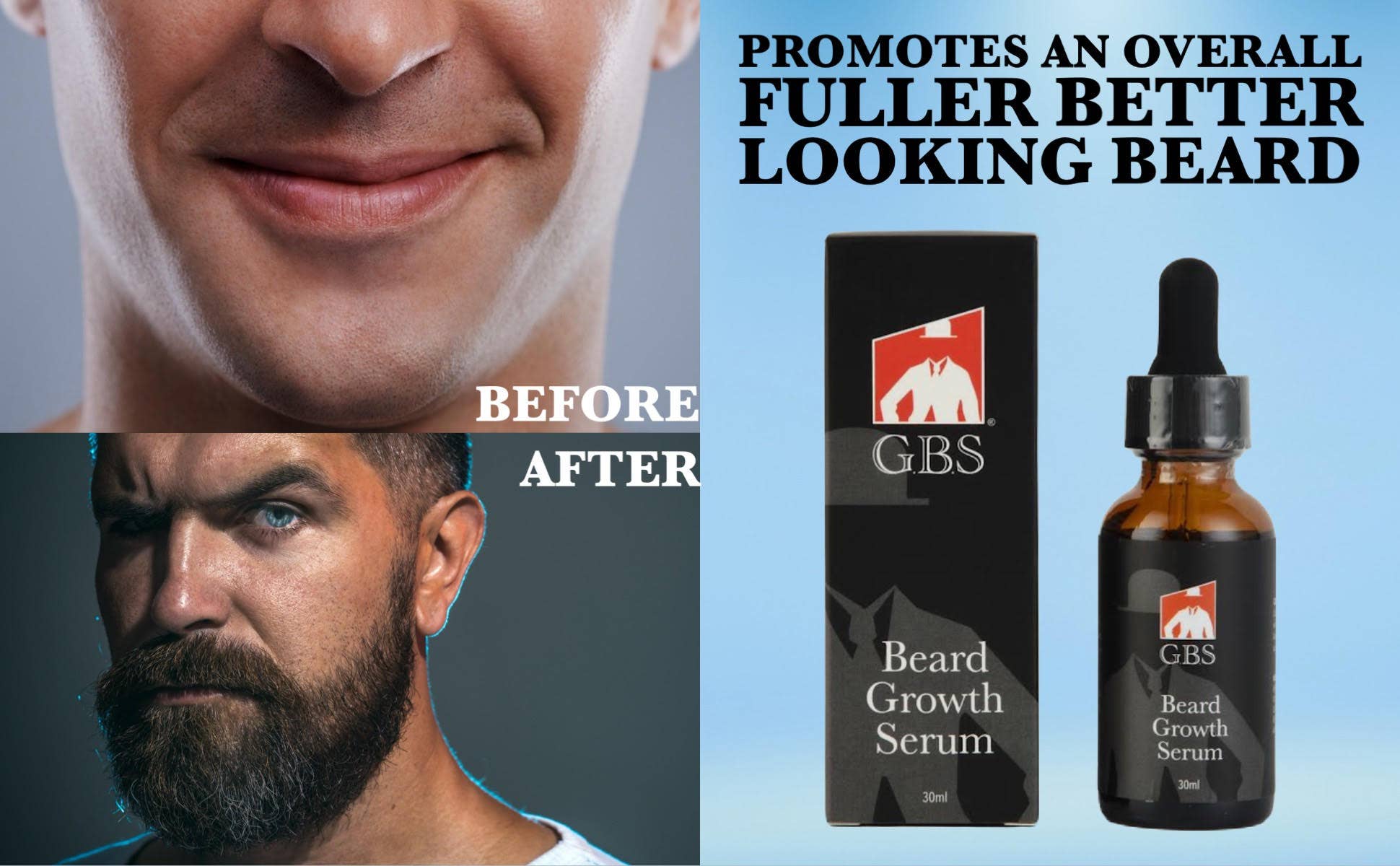 GBS Beard Growth Kit